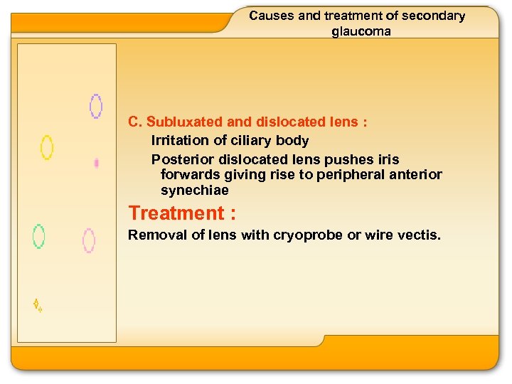 Causes and treatment of secondary glaucoma C. Subluxated and dislocated lens : Irritation of