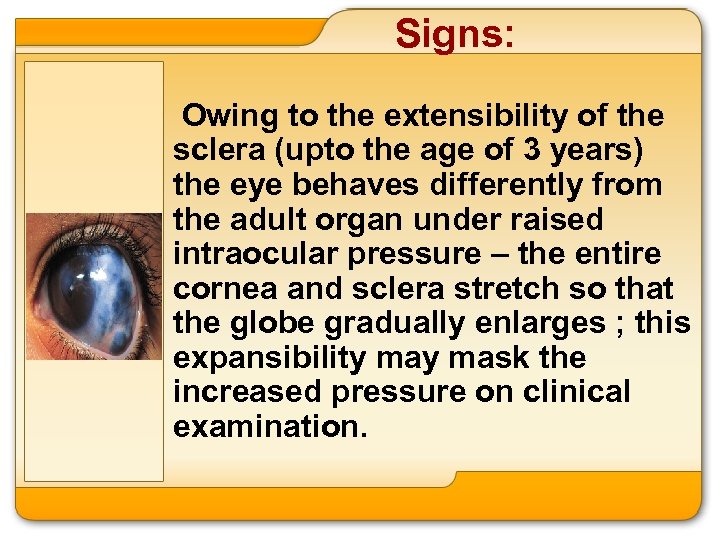 Signs: Owing to the extensibility of the sclera (upto the age of 3 years)
