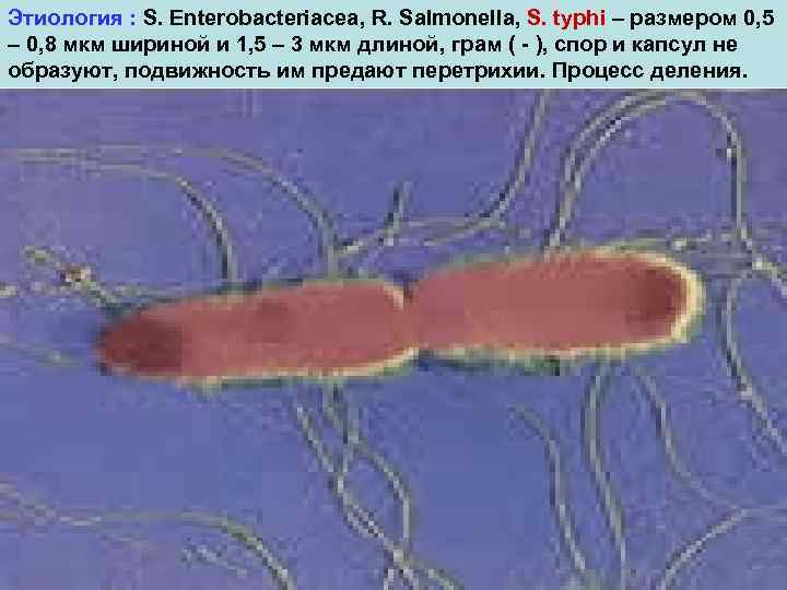 Этиология : S. Enterobacteriacea, R. Salmonella, S. typhi – размером 0, 5 – 0,