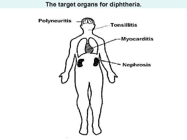 The target organs for diphtheria. 