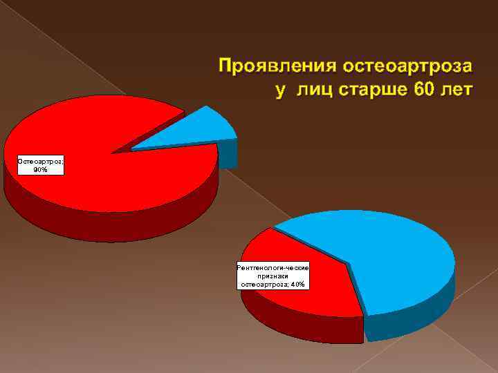 Проявления остеоартроза у лиц старше 60 лет Остеоартроз; 90% Рентгенологи-ческие признаки остеоартроза; 40% 