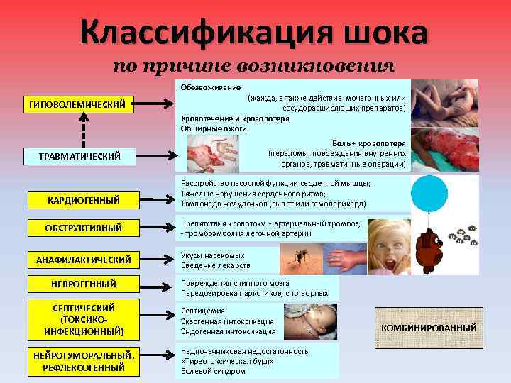 Классификация шока по причине возникновения Обезвоживание ГИПОВОЛЕМИЧЕСКИЙ (жажда, а также действие мочегонных или сосудорасширяющих