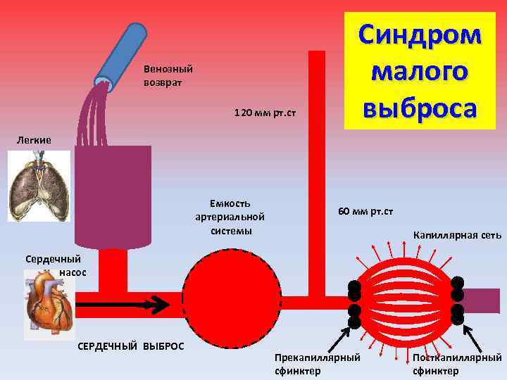 Венозный возврат 120 мм рт. ст Синдром малого выброса Легкие Емкость артериальной системы 60