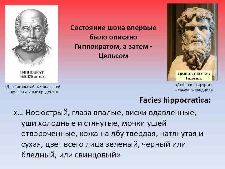 Состояние шока впервые было описано Гиппократом, а затем Цельсом ЦЕЛЬС (CELSUS) 1 в. до