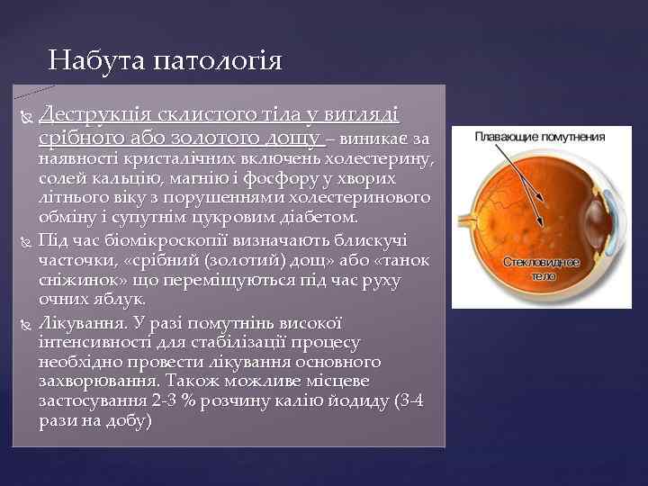 Набута патологія Деструкція склистого тіла у вигляді срібного або золотого дощу – виникає за