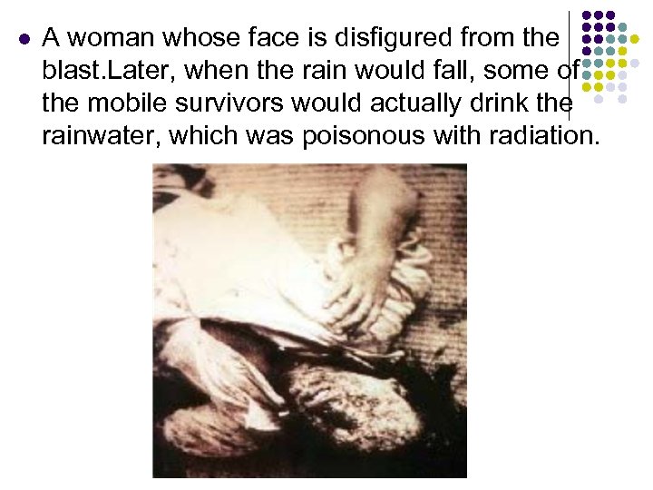 l A woman whose face is disfigured from the blast. Later, when the rain