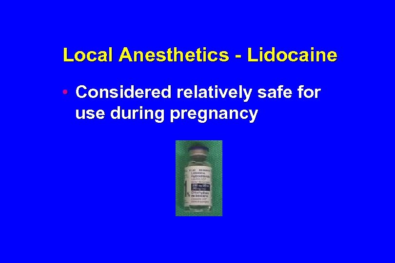 Local Anesthetics - Lidocaine • Considered relatively safe for use during pregnancy 