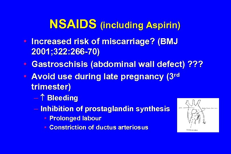 NSAIDS (including Aspirin) • Increased risk of miscarriage? (BMJ 2001; 322: 266 -70) •