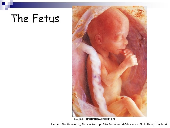 The Fetus S. J. ALLEN / INTERNATIONAL STOCK PHOTO Berger: The Developing Person Through