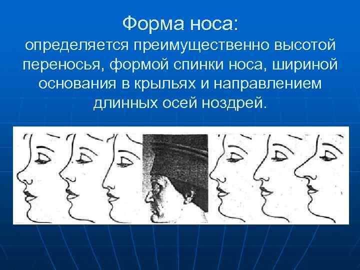 Формы носа. Форма спинки носа. Определить форму носа. Выпуклая спинка носа.