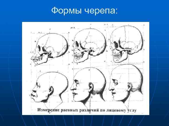 Форма черепа с боку