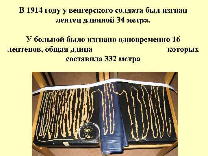В 1914 году у венгерского солдата был изгнан лентец длинной 34 метра. У больной