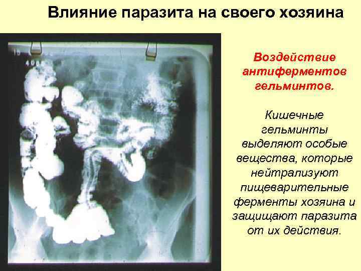 Влияние паразита на своего хозяина Воздействие антиферментов гельминтов. Кишечные гельминты выделяют особые вещества, которые