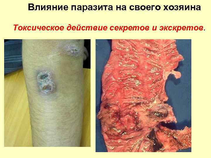 Влияние паразита на своего хозяина Токсическое действие секретов и экскретов. 