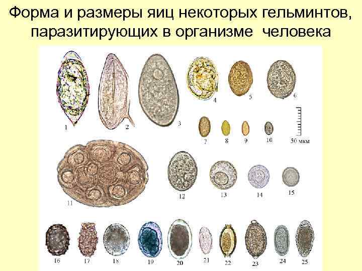Форма и размеры яиц некоторых гельминтов, паразитирующих в организме человека 