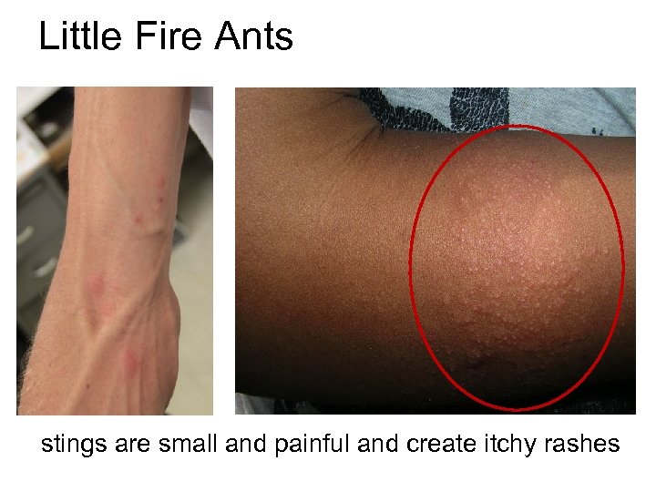 Little Fire Ants stings are small and painful and create itchy rashes 