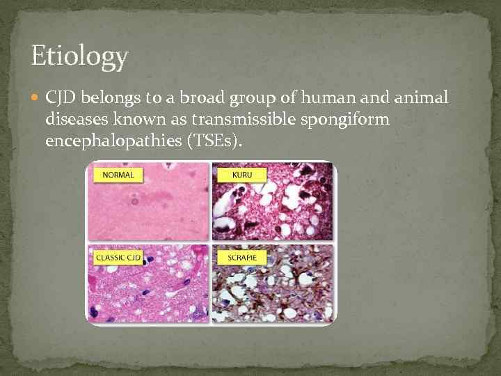 Etiology CJD belongs to a broad group of human and animal diseases known as