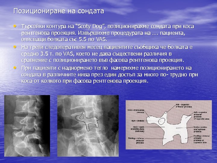 Позициониране на сондата • Търсейки контура на “Scoty Dog”, позиционирахме сондата при коса •