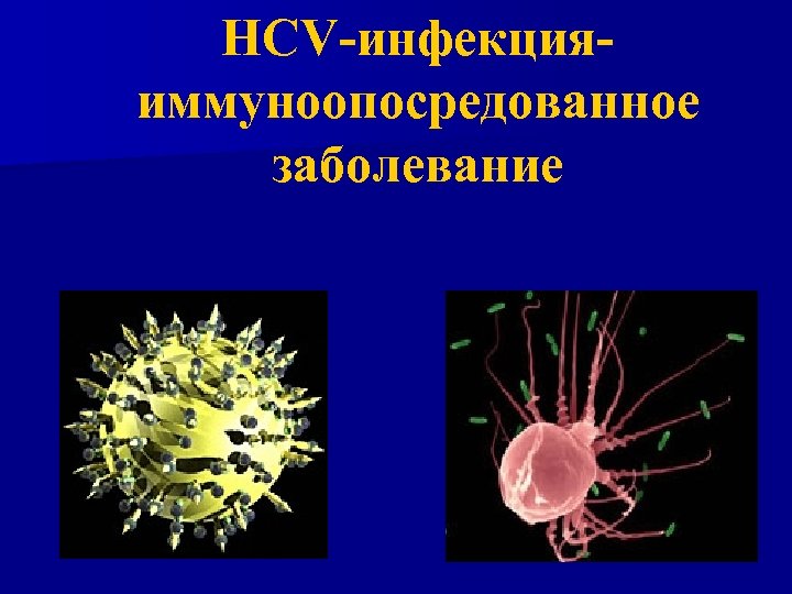 НСV-инфекцияиммуноопосредованное заболевание 