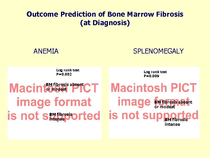 Outcome Prediction of Bone Marrow Fibrosis (at Diagnosis) ANEMIA Log rank test P=0. 002