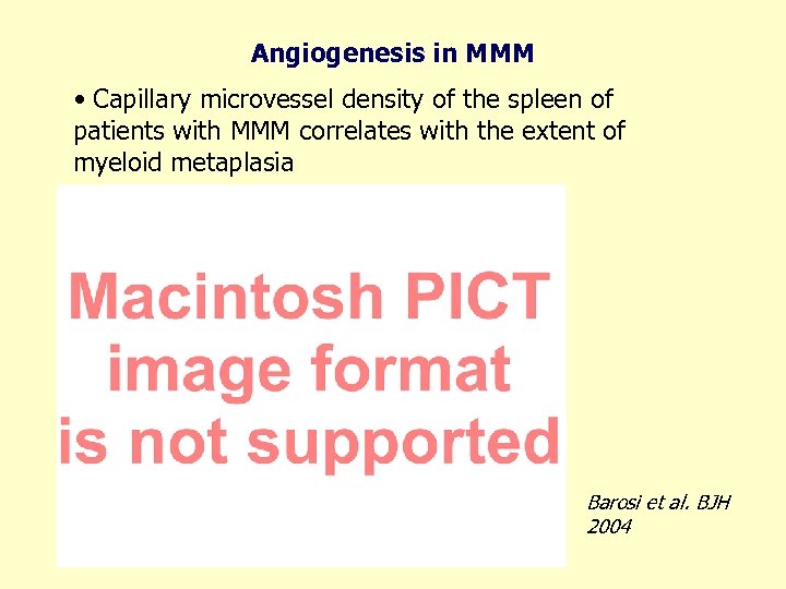 Angiogenesis in MMM • Capillary microvessel density of the spleen of patients with MMM