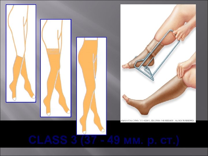 CLASS 3 (37 - 49 мм. р. ст. ) 