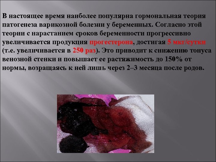 В настоящее время наиболее популярна гормональная теория патогенеза варикозной болезни у беременных. Согласно этой