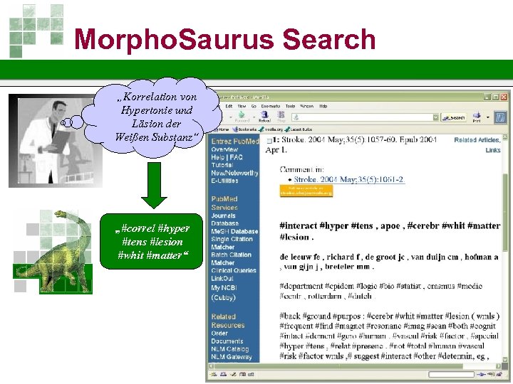 Morpho. Saurus Search „Korrelation von Hypertonie und Läsion der Weißen Substanz“ „#correl #hyper #tens