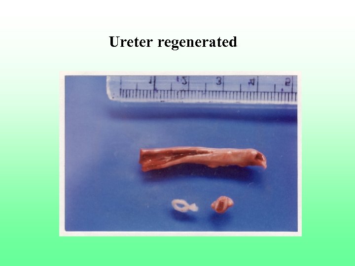 Ureter regenerated 