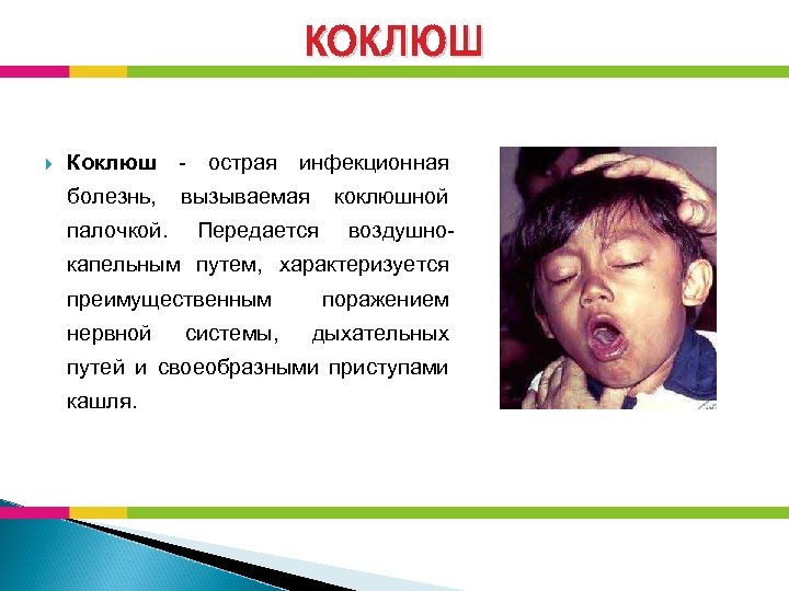 КОКЛЮШ Коклюш - острая инфекционная болезнь, вызываемая коклюшной палочкой. Передается воздушно- капельным путем, характеризуется