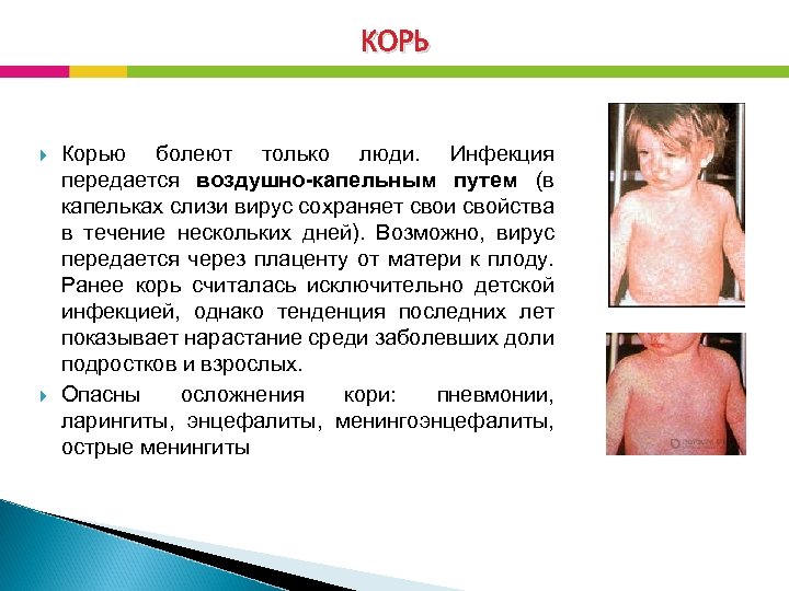 КОРЬ Корью болеют только люди. Инфекция передается воздушно-капельным путем (в капельках слизи вирус сохраняет