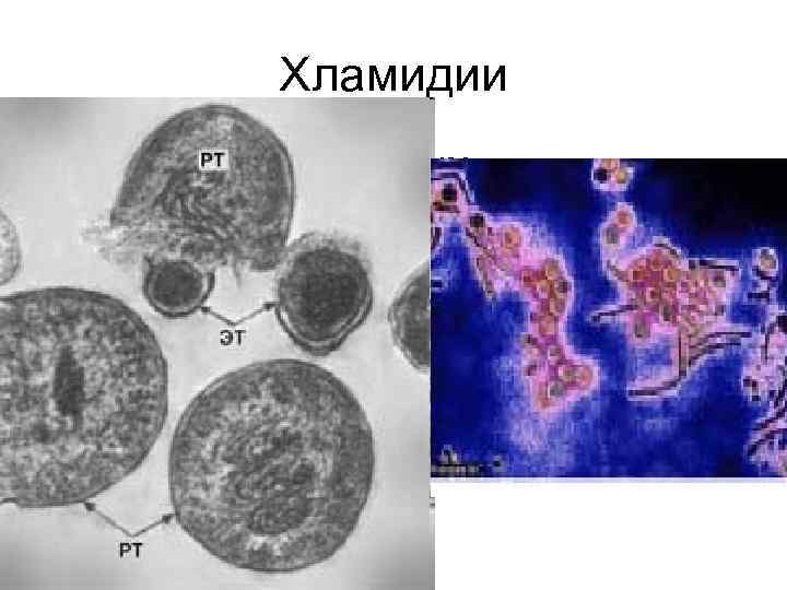 Хламидии • относятся к облигатным внутриклеточным кокковидным грамотрицательным бактериям. Они размножаются только в живых