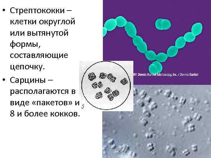  • Стрептококки – клетки округлой или вытянутой формы, составляющие цепочку. • Сарцины –