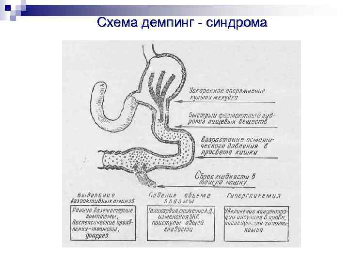 Демпинг синдром патофизиология презентация