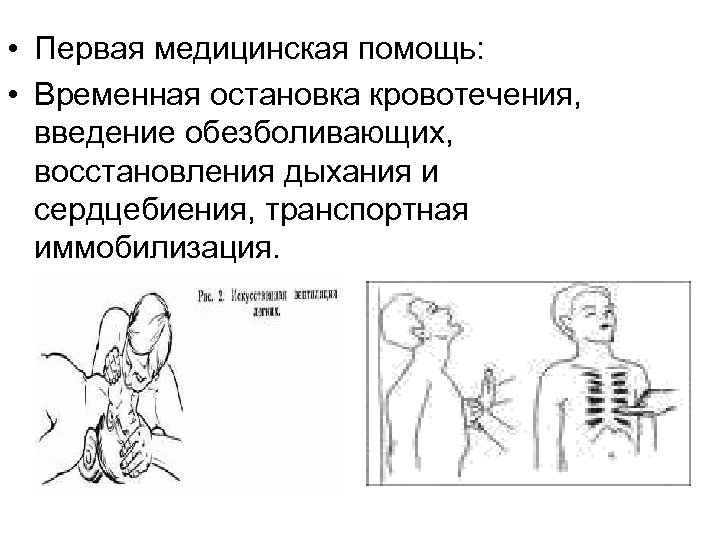  • Первая медицинская помощь: • Временная остановка кровотечения, введение обезболивающих, восстановления дыхания и