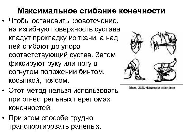 Максимальное сгибание конечности • Чтобы остановить кровотечение, на изгибную поверхность сустава кладут прокладку из