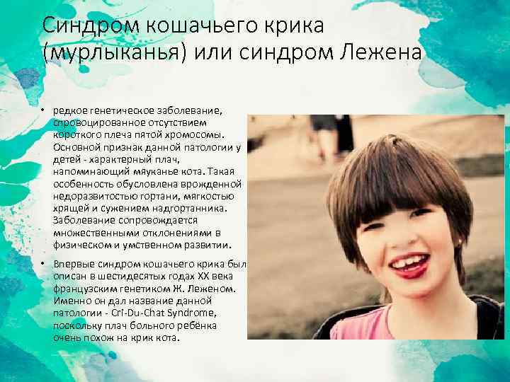 Синдром кошачьего крика (мурлыканья) или синдром Лежена • редкое генетическое заболевание, спровоцированное отсутствием короткого