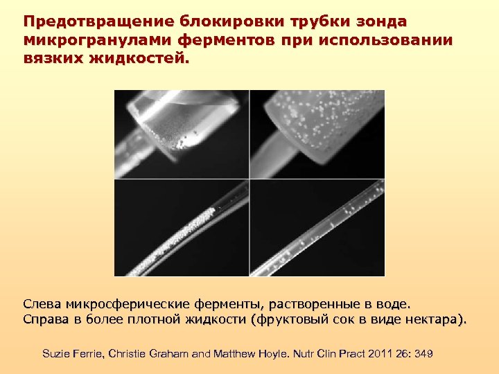 Предотвращение блокировки трубки зонда микрогранулами ферментов при использовании вязких жидкостей. Слева микросферические ферменты, растворенные