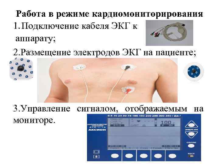 Работа в режиме кардиомониторирования 1. Подключение кабеля ЭКГ к аппарату; 2. Размещение электродов ЭКГ