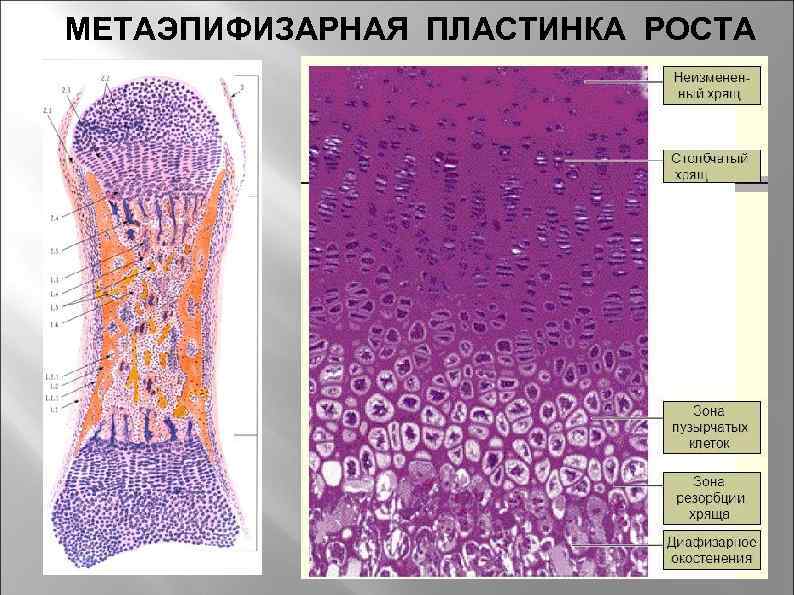 Пластина роста. Эпифизарная пластинка гистология. Эпифизарная пластинка гистология препарат. Непрямой остеогенез гистология препарат. Эпифизарная пластинка роста кости.