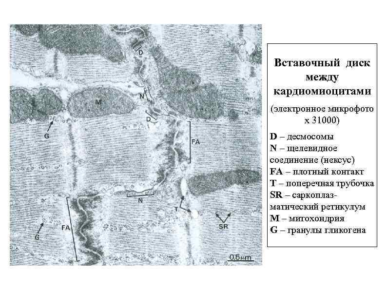 Вставочный диск между кардиомиоцитами (электронное микрофото x 31000) D – десмосомы N – щелевидное