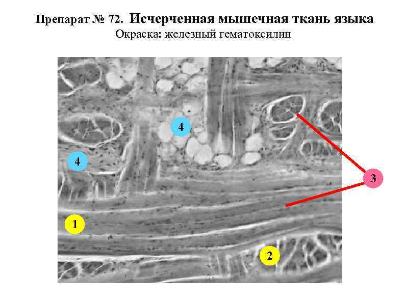 Препарат № 72. Исчерченная мышечная ткань языка Окраска: железный гематоксилин 4 4 3 1