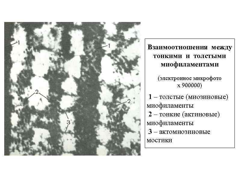 Взаимоотношения между тонкими и толстыми миофиламентами (электронное микрофото х 900000) 1 – толстые (миозиновые)
