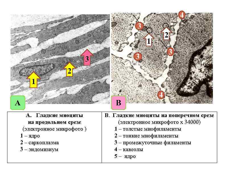 Схема изменения структуры гладкого миоцита до и после сокращения