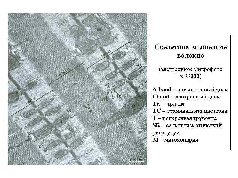 Скелетное мышечное волокно (электронное микрофото x 33000) A band – анизотропный диск I band