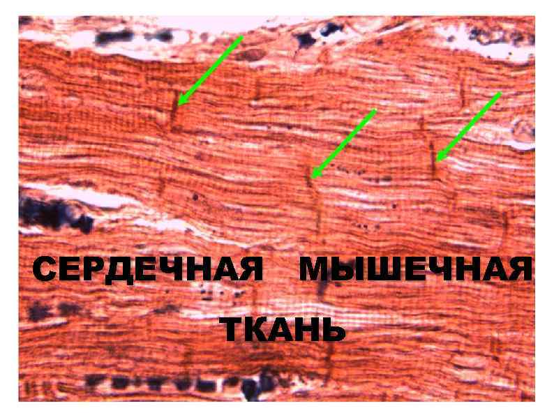 СЕРДЕЧНАЯ МЫШЕЧНАЯ ТКАНЬ 