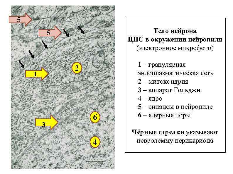 Тело нейрона лежит за пределами цнс