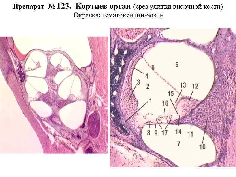 Препарат № 123. Кортиев орган (срез улитки височной кости) Окраска: гематоксилин-эозин 