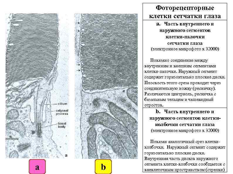 Фоторецепторные клетки сетчатки глаза а. Часть внутреннего и наружного сегментов клетки-палочки сетчатки глаза (электронное