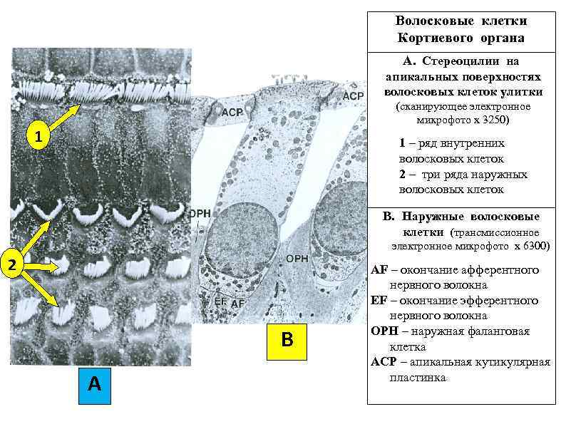 Наружные волосковые клетки улитки